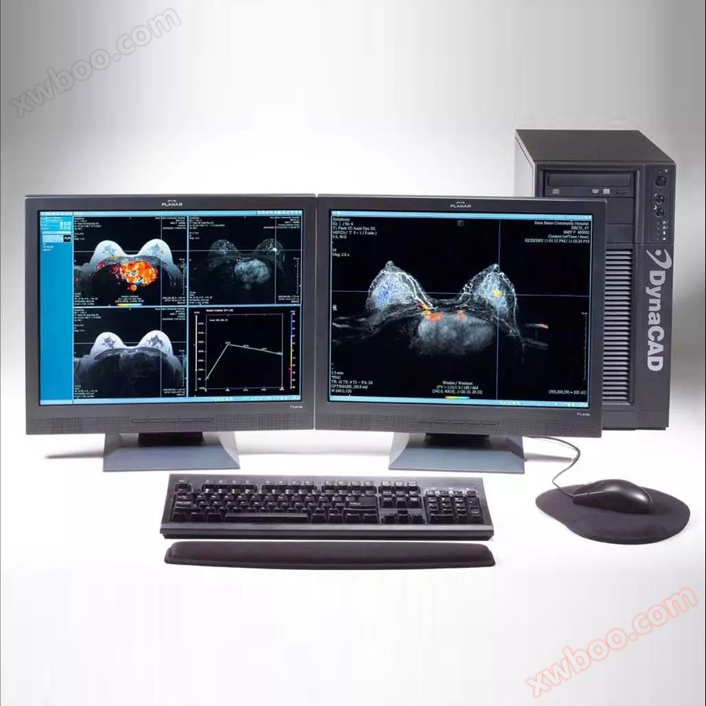 Systém pro analýzu a lokalizaci obrázků prsu Invivo